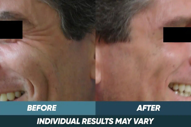 before-after-img-1