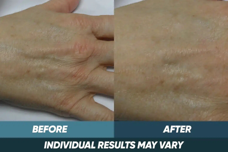 before-after-img-3