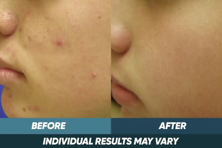 before-after-img-4