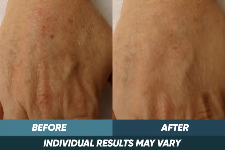 before-after-img-5