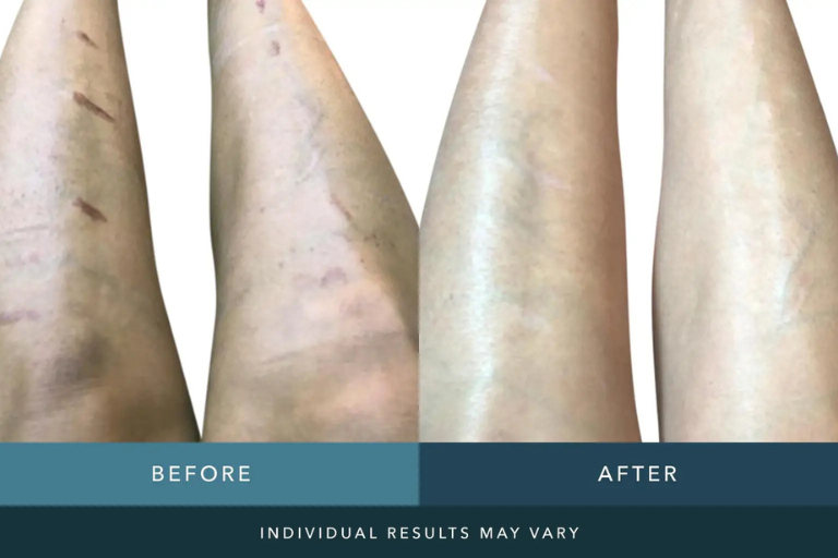 before-after-img-6