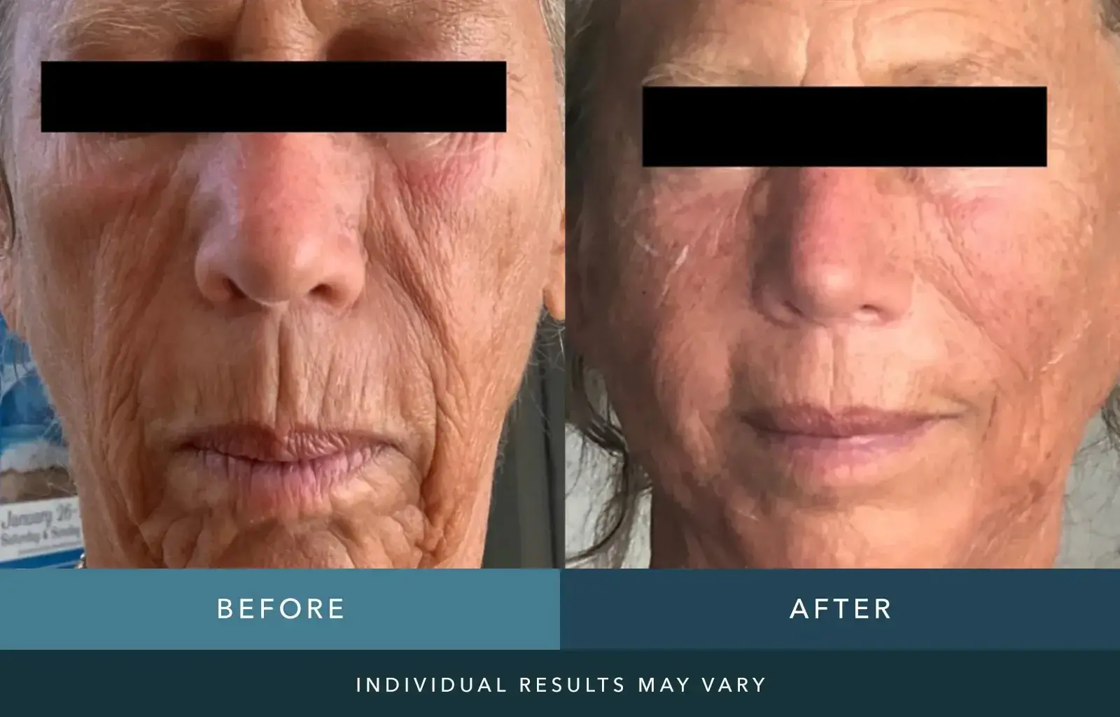before_and_after-jpg